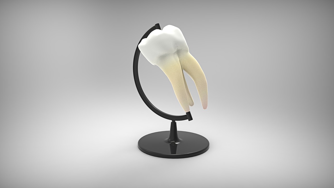 Implant dentar