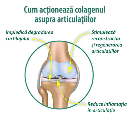 inflamația cartilajului în articulații)